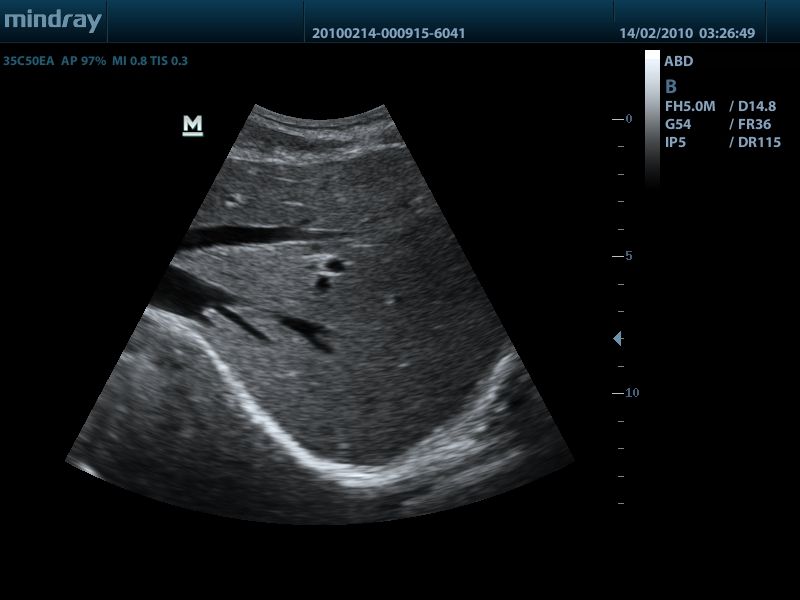 MINDRAY DP 50