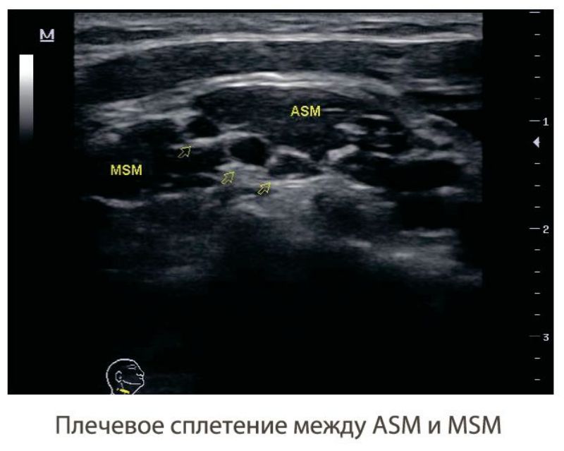 MINDRAY M5