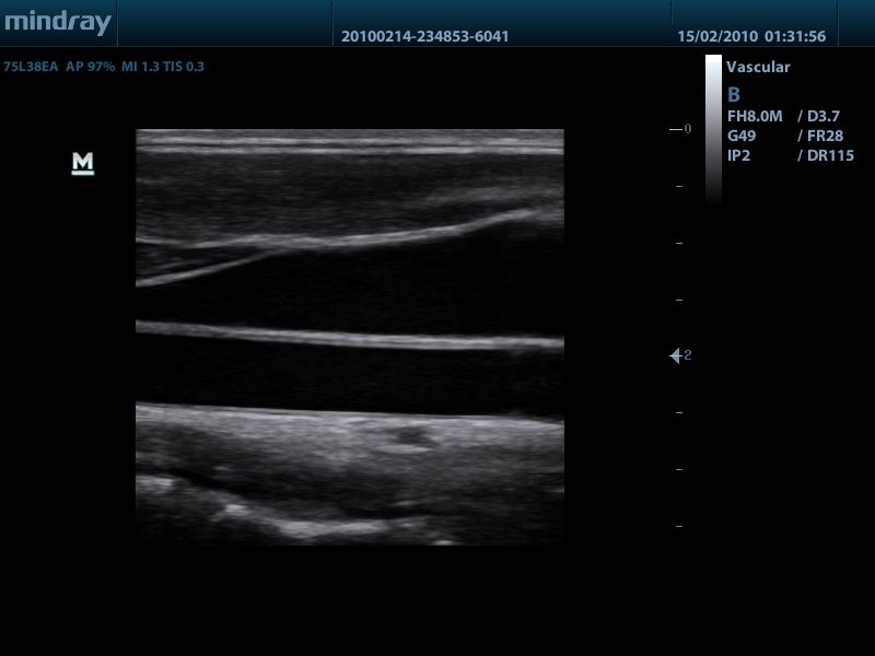 MINDRAY DP 50