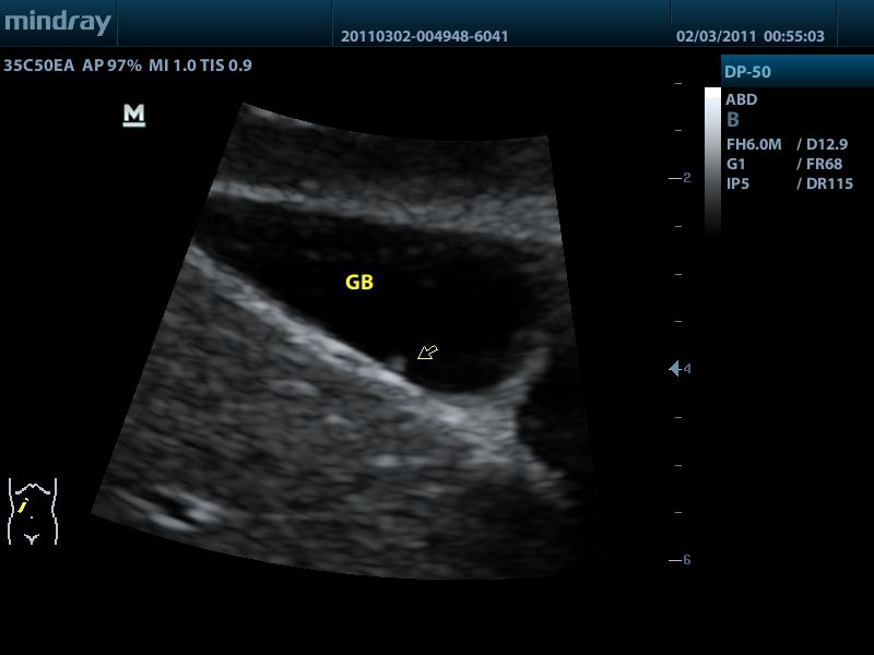 MINDRAY DP 50