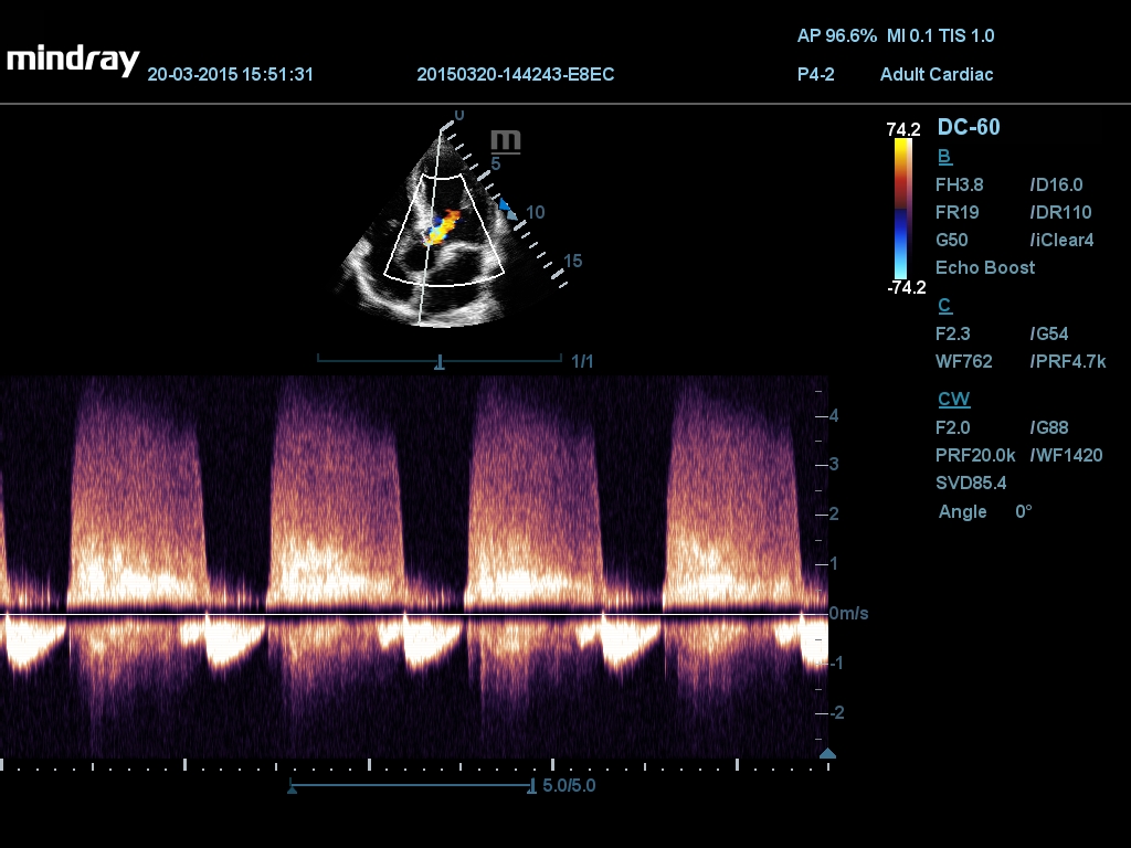 MINDRAY DC-70 X-nsight