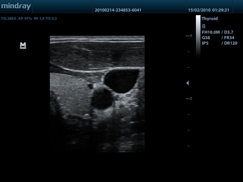 MINDRAY DP 50